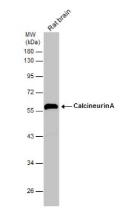 Calcineurin A Antibody, Novus Biologicals 0.1mL; Unlabeled:Antibodies