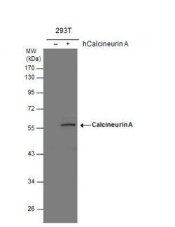 Calcineurin A Antibody, Novus Biologicals 0.1mL; Unlabeled:Antibodies