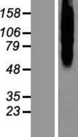 Novus Biologicals&trade;&nbsp;Calcitonin R Overexpression Lysate