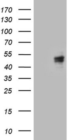 Calcium Activated Nucleotidase 1/CANT1 Antibody (OTI7F8), Novus Biologicals