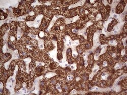 Calcium Activated Nucleotidase 1/CANT1 Antibody (OTI7F8), Novus Biologicals