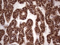 Calcium Activated Nucleotidase 1/CANT1 Antibody (OTI7F8), Novus Biologicals