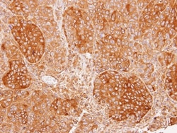 Calcium-binding-protein-P22 Antibody, Novus Biologicals 0.1mg; Unlabeled:Antibodies,