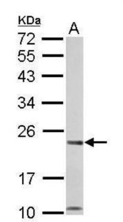 Calcium-binding-protein-P22 Antibody, Novus Biologicals 0.1mg; Unlabeled:Antibodies,