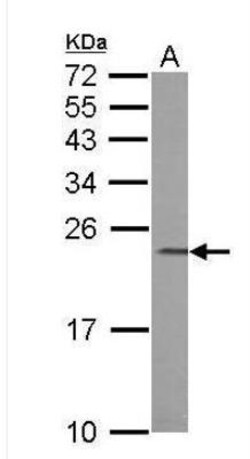 Calcium-binding-protein-P22 Antibody, Novus Biologicals 0.1mg; Unlabeled:Antibodies,