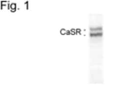 Calcium-sensing R/CaSR Antibody (5C10, ADD) - BSA Free, Novus Biologicals 0.1 mg | Buy Online | Novus Biologicals | Fisher Scientific
