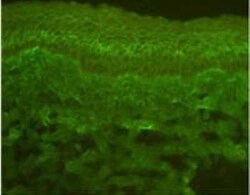 Calcium-sensing R/CaSR Antibody (5C10, ADD) - BSA Free, Novus Biologicals 0.1 mg | Buy Online | Novus Biologicals | Fisher Scientific