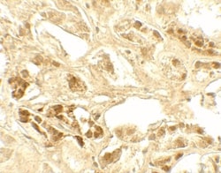 Calcium-sensing R/CaSR Antibody - BSA Free, Novus Biologicals:Antibodies:Primary