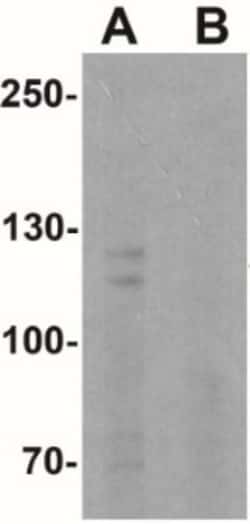 Calcium-sensing R/CaSR Antibody - BSA Free, Novus Biologicals:Antibodies:Primary