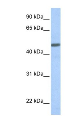 CRLR Antibody, Novus Biologicals 0.05mg; Unlabeled:Antibodies, Polyclonal