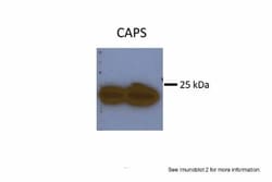 Calcyphosine Antibody, Novus Biologicals:Antibodies:Primary Antibodies