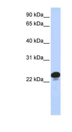 Calcyphosine Antibody, Novus Biologicals:Antibodies:Primary Antibodies
