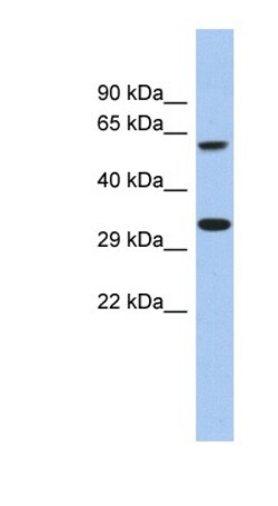 CALHM3 Antibody, Novus Biologicals 100&mu;L; Unlabeled:Antibodies, Polyclonal