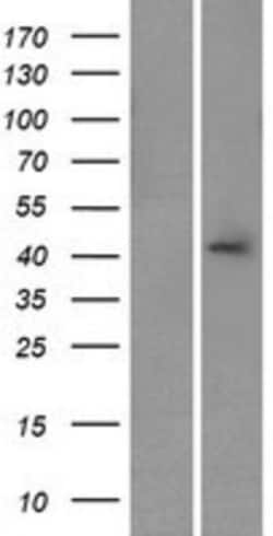 Novus Biologicals&trade;&nbsp;CALHM3 Overexpression Lysate