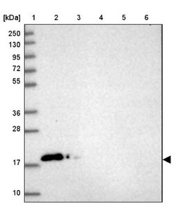 CALML3 Antibody, Novus Biologicals 0.1mL; Unlabeled:Antibodies, Polyclonal