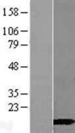 Novus Biologicals&trade;&nbsp;CALML3 Overexpression Lysate