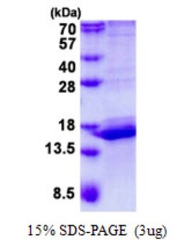 Novus Biologicals&trade;&nbsp;Recombinant Human CALML3 His Protein