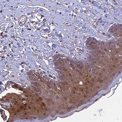 CALML3 Antibody, Novus Biologicals 0.1mL; Unlabeled:Antibodies, Polyclonal