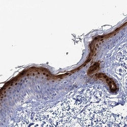 CALML5 Antibody, Novus Biologicals 25 &mu;L; Unlabeled:Antibodies, Polyclonal