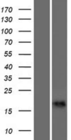 Novus Biologicals&trade;&nbsp;CALML6 Overexpression Lysate