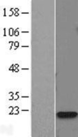 Novus Biologicals&trade;&nbsp;Calmodulin 2 Overexpression Lysate