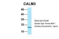 Calmodulin 3 Antibody, Novus Biologicals:Antibodies:Primary Antibodies