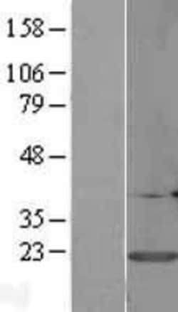 Novus Biologicals™ Calmodulin 3 Overexpression Lysate