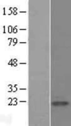 Novus Biologicals&trade;&nbsp;Calmodulin Overexpression Lysate