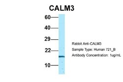 Calmodulin 3 Antibody, Novus Biologicals:Antibodies:Primary Antibodies