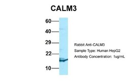 Calmodulin 3 Antibody, Novus Biologicals:Antibodies:Primary Antibodies