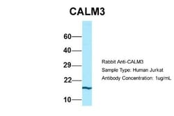 Calmodulin 3 Antibody, Novus Biologicals:Antibodies:Primary Antibodies