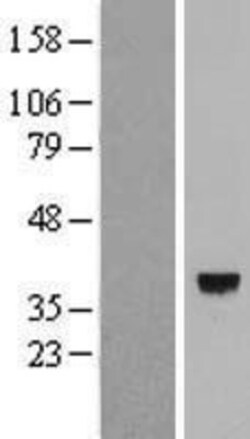 Novus Biologicals™ calmodulin-lysine N-methyltransferase Overexpression Lysate