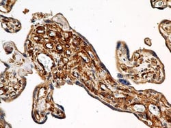 Calnexin Antibody (1C2.2D11) - BSA Free, Novus Biologicals 0.1mg; Unlabeled:Antibodies,