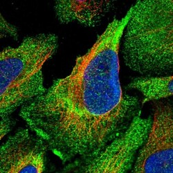 Calpain 13 Antibody, Novus Biologicals 0.1mL; Unlabeled:Antibodies, Polyclonal