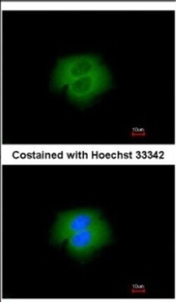 anti-Calpain 2, Polyclonal, Novus Biologicals 0.1mL; Unlabeled:Antibodies,