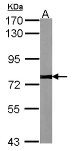 anti-Calpain 2, Polyclonal, Novus Biologicals 0.1mL; Unlabeled:Antibodies,