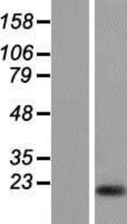 Novus Biologicals&trade;&nbsp;Calpain 3 Overexpression Lysate