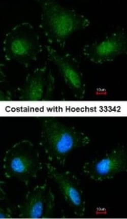 Calpain 5 Antibody, Novus Biologicals 0.1mL; Unlabeled:Antibodies, Polyclonal