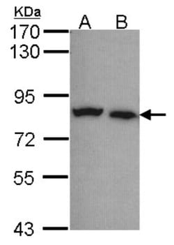 Calpain 5 Antibody, Novus Biologicals 0.1mL; Unlabeled:Antibodies, Polyclonal