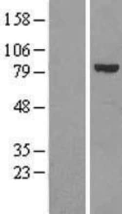 Novus Biologicals&trade;&nbsp;Calpain 6 Overexpression Lysate