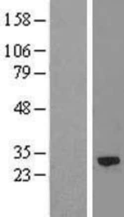 Novus Biologicals&trade;&nbsp;Calpain S2 Overexpression Lysate