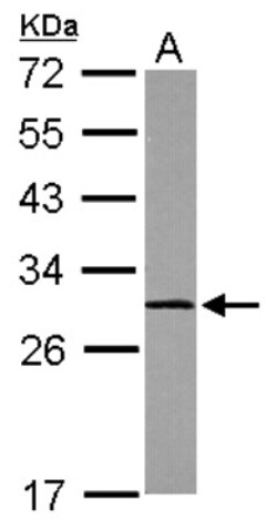 Calpain S1 Antibody, Novus Biologicals 0.1mL; Unlabeled:Antibodies, Polyclonal