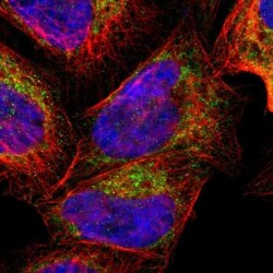 Calpain 10 Antibody, Novus Biologicals:Antibodies:Primary Antibodies