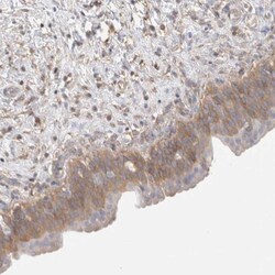 Calpain 2 Antibody, Novus Biologicals 0.1mL; Unlabeled:Antibodies, Polyclonal