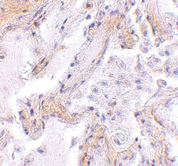 Calpain 6 Antibody - BSA Free, Novus Biologicals 0.1mg; Unlabeled:Antibodies,