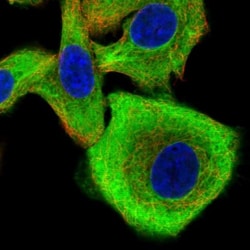 Calpastatin Antibody, Novus Biologicals 25 &mu;L, Unlabeled:Antibodies,