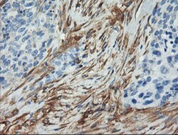 Calponin 2 Antibody (OTI2B5), Novus Biologicals 0.1mL; Unlabeled:Antibodies,