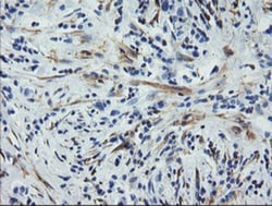 Calponin 2 Antibody (OTI2B5), Novus Biologicals 0.1mL; Unlabeled:Antibodies,