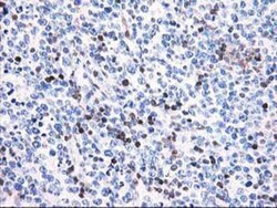 Calponin 2 Antibody (OTI2B5), Novus Biologicals 0.1mL; Unlabeled:Antibodies,