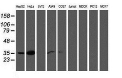 Calponin 2 Antibody (OTI2B5), Novus Biologicals 0.1mL; Unlabeled:Antibodies,
